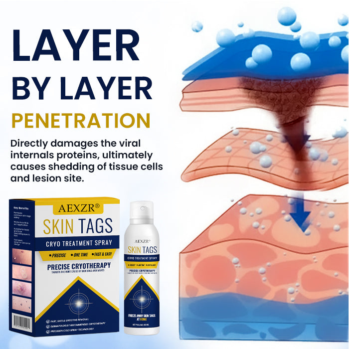 CryoClear Skin Spray